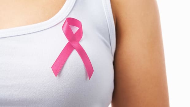 A. How to Reduce Your Risk for Breast Cancer Promo Image