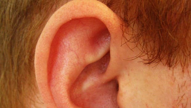 Q. How to Tell if Ear Cartilage Is Infected Promo Image