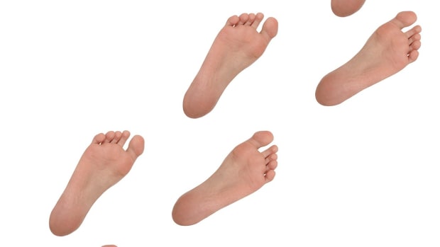 ZE. How to Know If You Have a Heel Spur | Foot Care Promo Image
