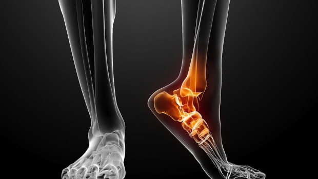 A. How to Avoid Foot Pain in the Heel | Foot Care Promo Image