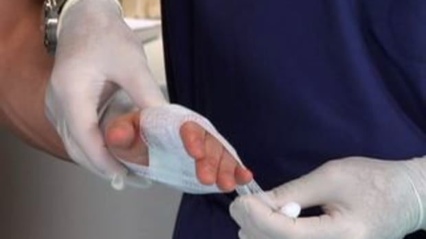 I. How to Bandage a Hand Promo Image