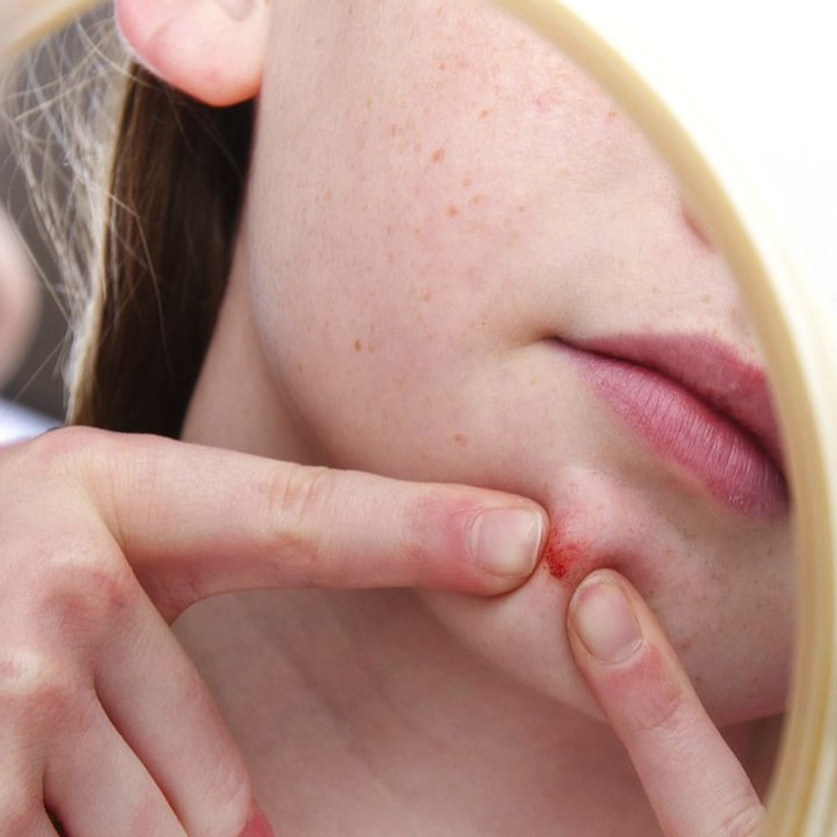 Huge zit sales