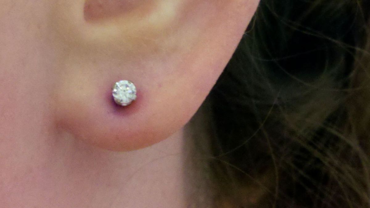 How To Prevent An Infection From Ear Piercing Howcast The How To Prevent An Infection From Ear Piercing Howcast The Best Videos