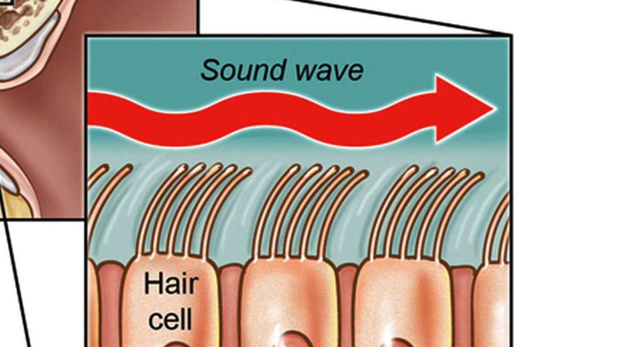 3 Different Types of Hearing Loss Howcast