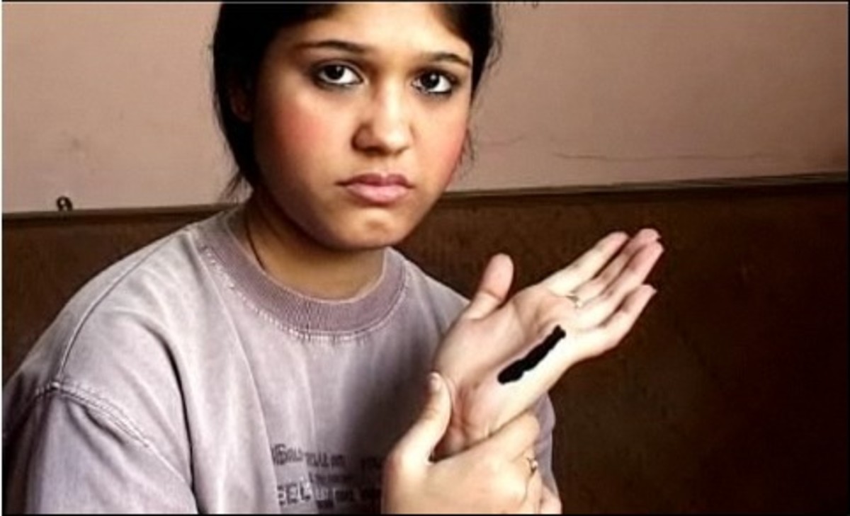 How to Remove Tar From Skin Howcast