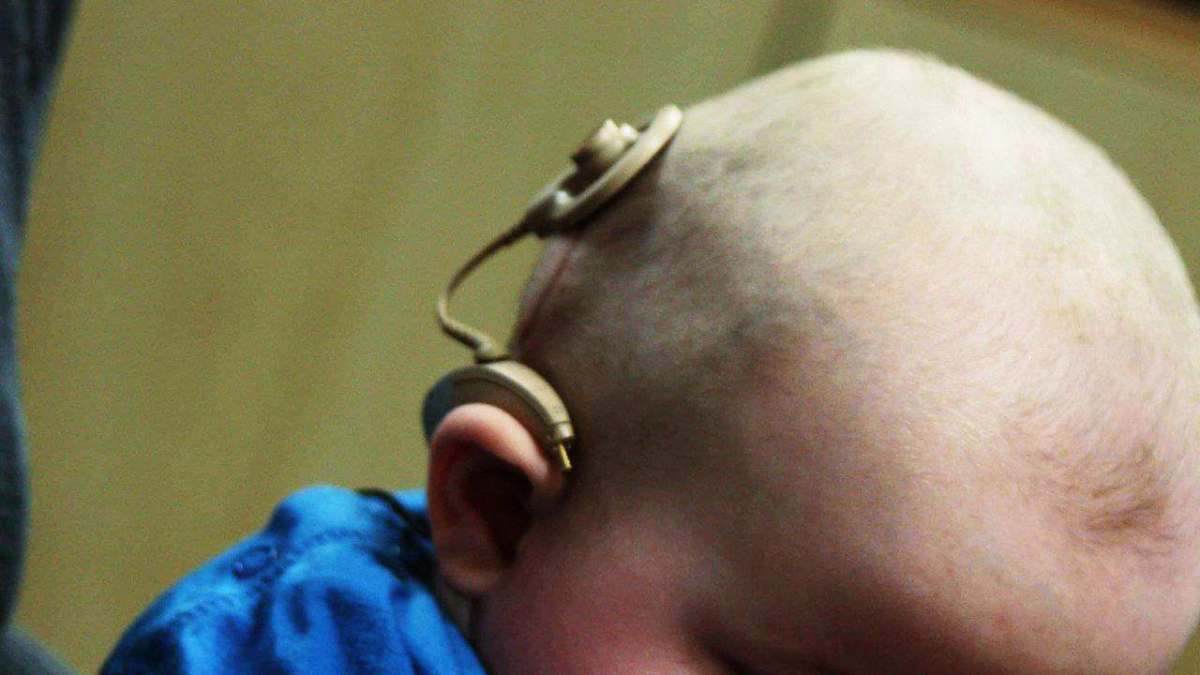 Who Is a Good Candidate for a Cochlear Implant? Howcast